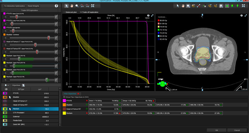 Varian receives 510(k) clearance for Eclipse v16 proton therapy planning software