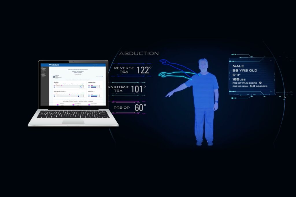 Exactech Launches Predict+™, Machine Learning-Based Clinical Support Tool