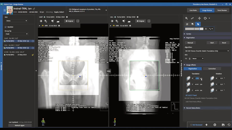 Early Adopters Begin Using  Elekta’s MOSAIQ 3 Series