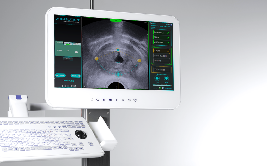 Growing Coverage for PROCEPT BioRobotics Aquablation Therapy