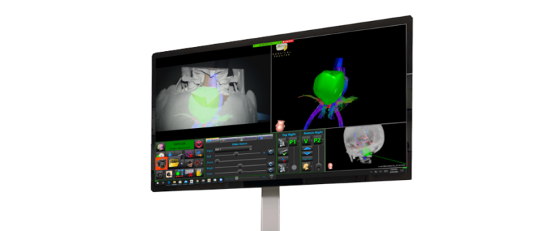 medtronic-syncar-surgical-navigation