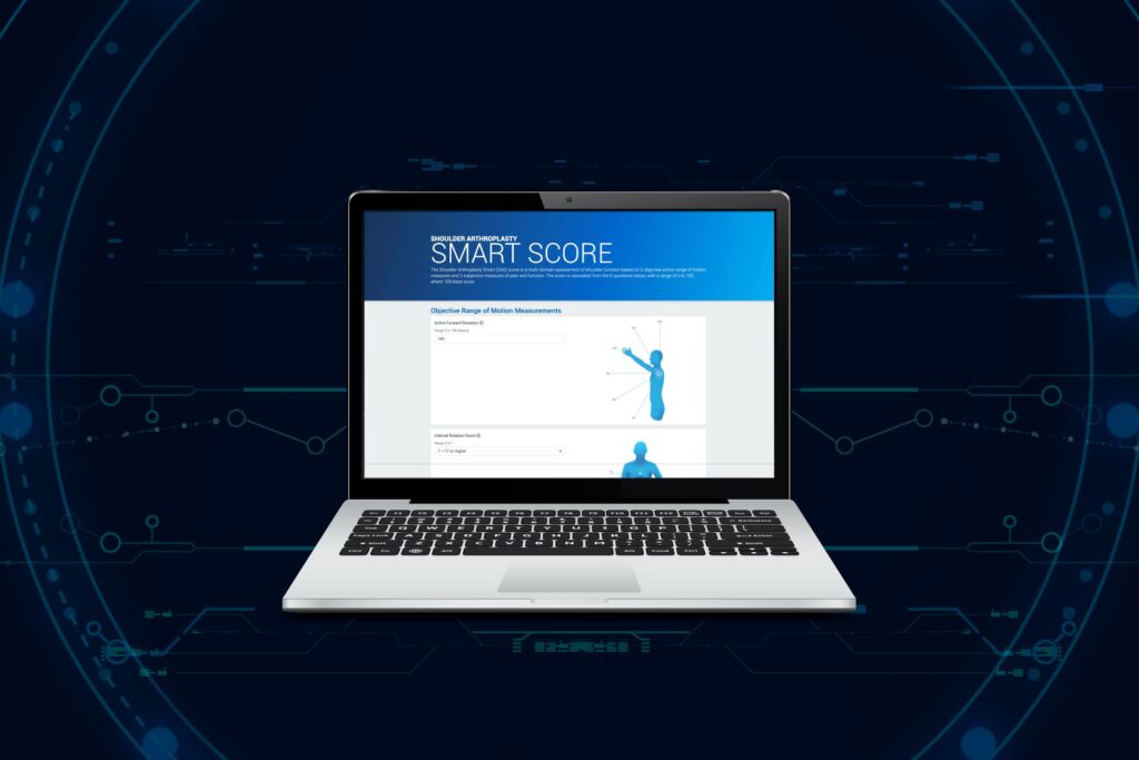 Exactech Shares Industry’s First Shoulder Replacement Surgery “Smart Score” Metric Based on Machine Learning