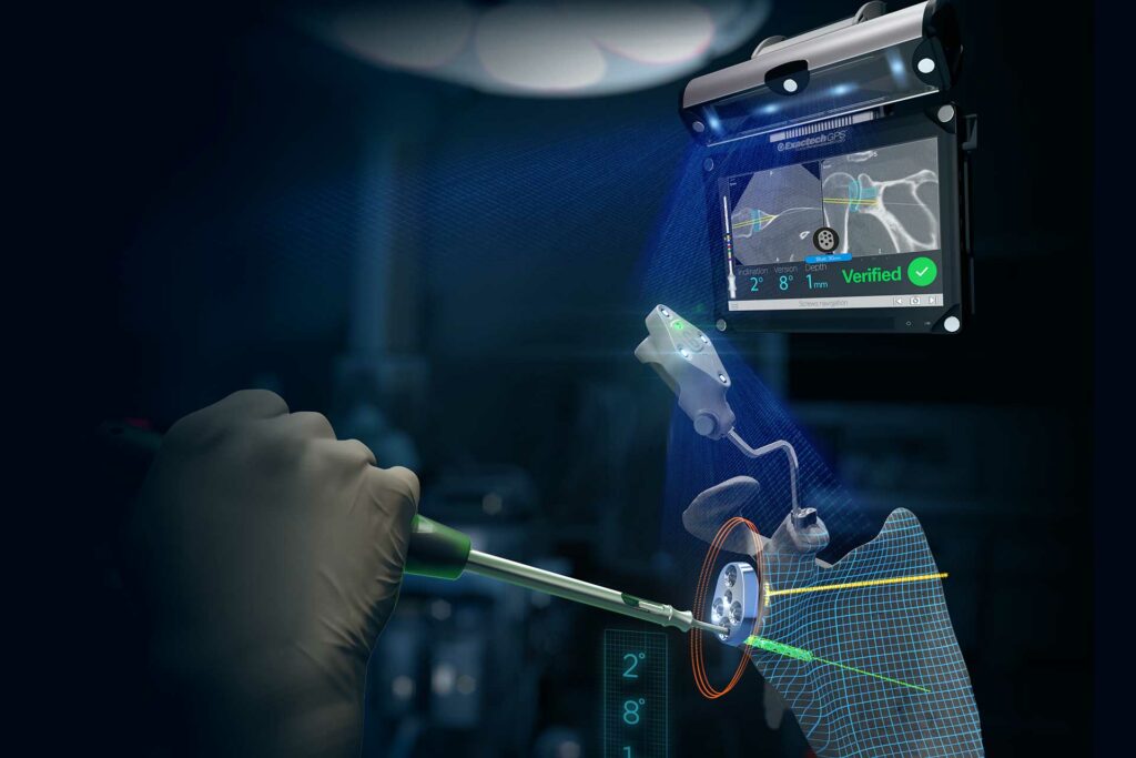 Exactech Advances ExactechGPS® Shoulder Replacement Navigation Software and Planning App