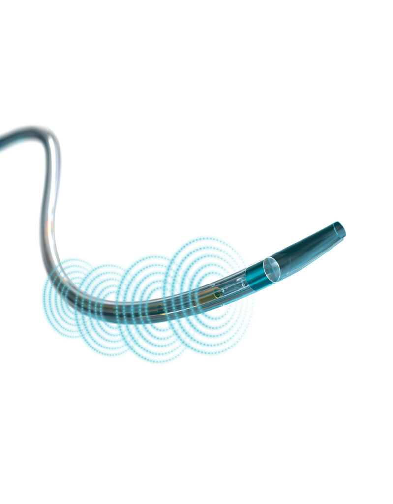 Boston Scientific Begins Randomized Controlled Trial for the EkoSonic™ Endovascular System