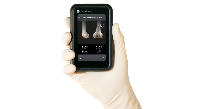OrthAlign Celebrates Milestone of 200,000 Joint Arthroplasty Cases