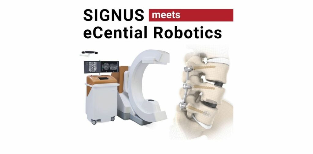 signus-ecential-robotics