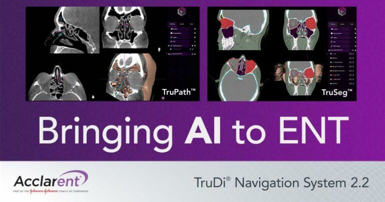 Ent Technology Interface Acclarent Launches First AI-Powered ENT Navigation Technology
