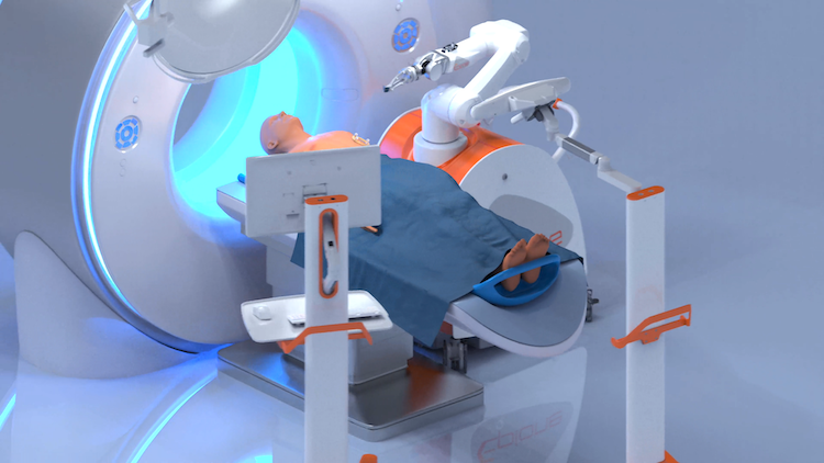 Quantum Surgical Announces First Center in World to Adopt its Epione® Medical Robot