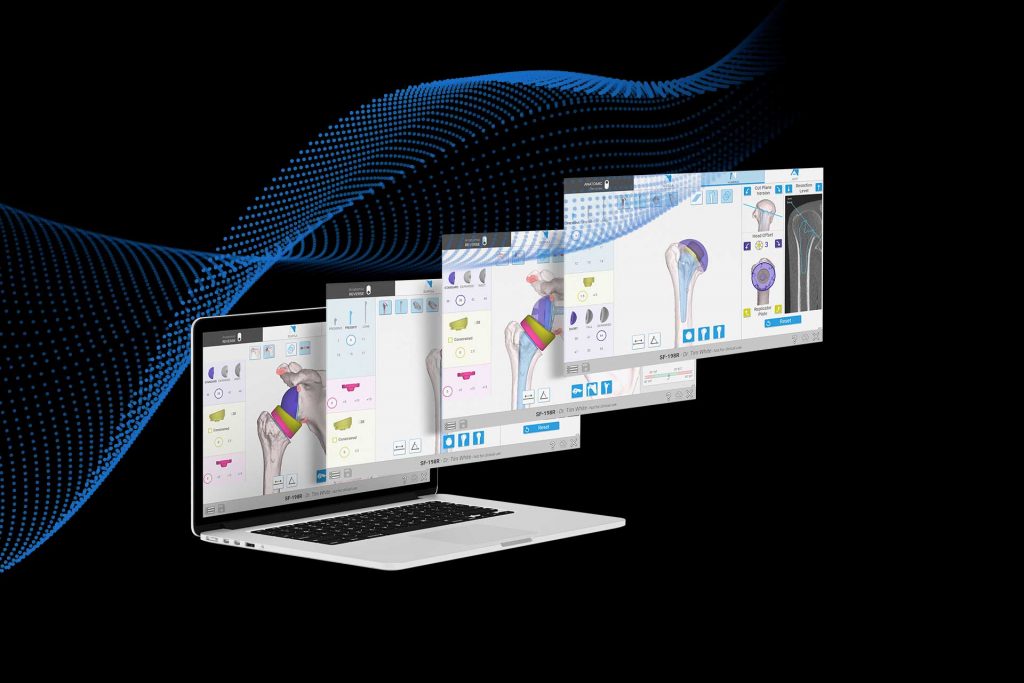 Exactech Secures FDA 510(K) Clearance for Equinoxe® Planning App (v. 2.0)