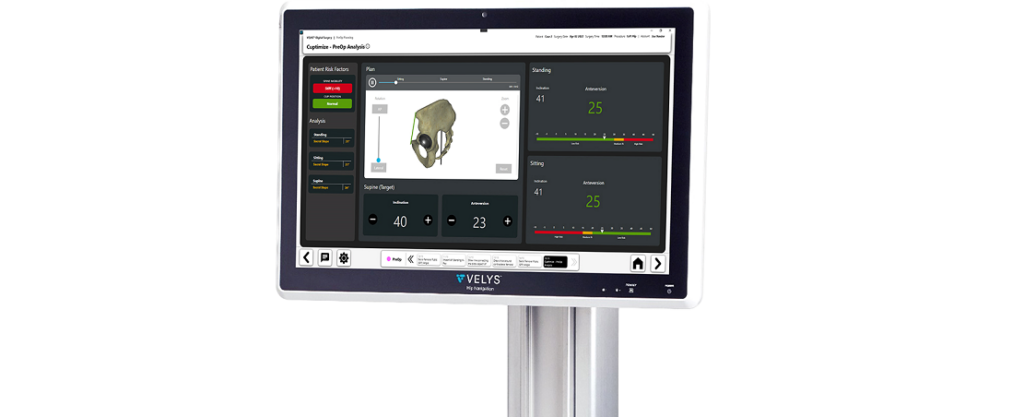 DePuy Synthes Acquires CUPTIMIZE™ Hip-Spine Analysis
