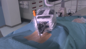 interventional-systems-micromate