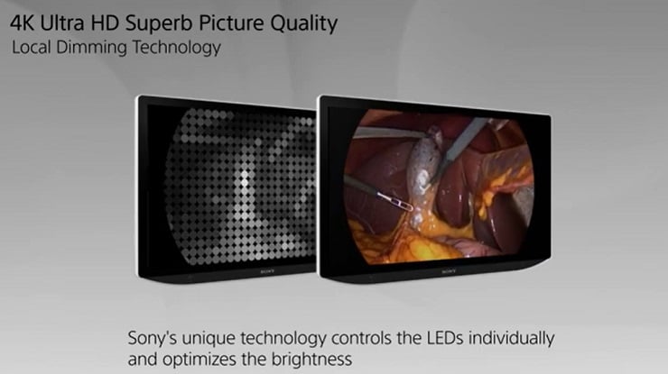 new-generation-surgical-displays