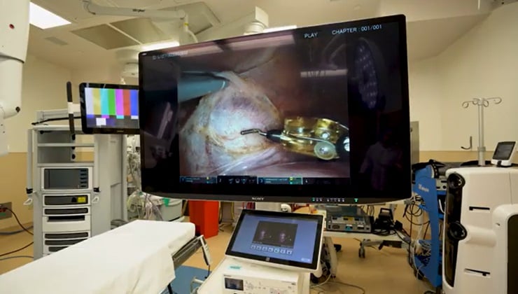 sony-surgical-display-advantages