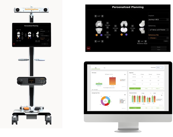 Smith+Nephew to Showcase AI-driven Robotic-assisted Solutions at AAOS 2024