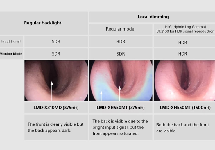 Local dimming medical applications