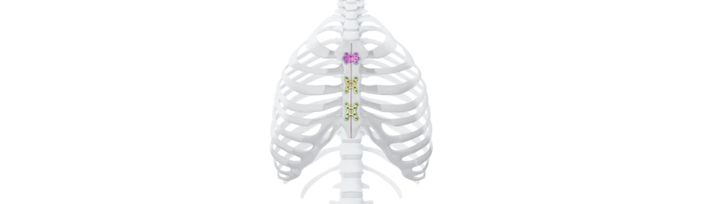 DePuy Synthes Launches MatrixSTERNUM™ Fixation System