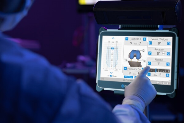 Exactech Announces New Balancing Technology for Knee Replacement Patients