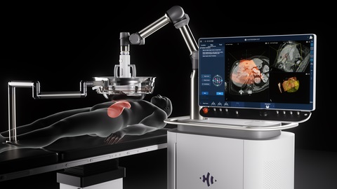 HistoSonics Announces First Patients Treated in GANNON Trial