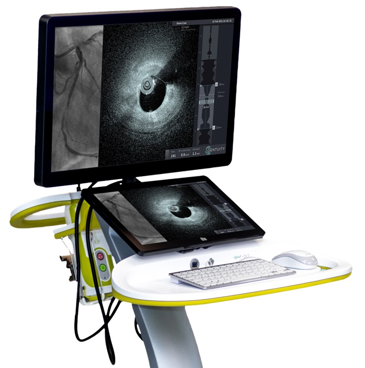 Gentuity® Receives FDA 510(k) Clearance for HF-OCT Imaging System