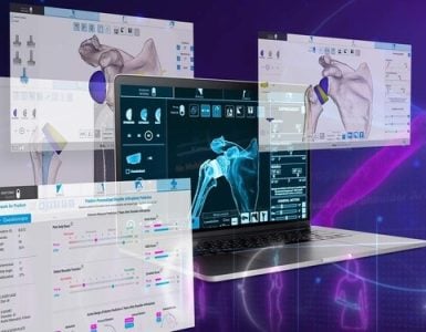 Shoulder Planning App