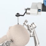 Single-Use 2D/3D Neuro-Endoscope