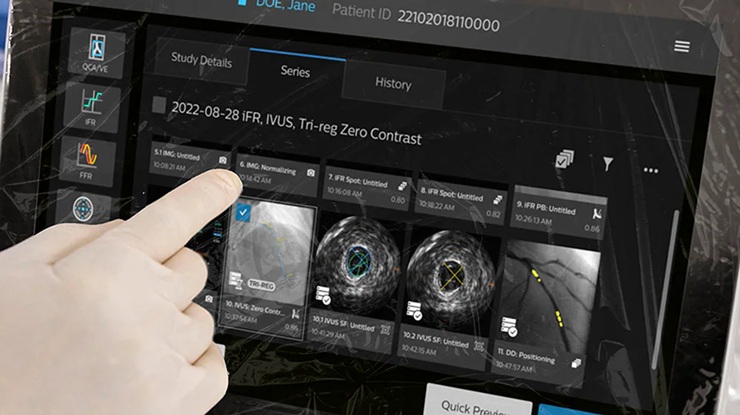 Philips launches IntraSight Plus