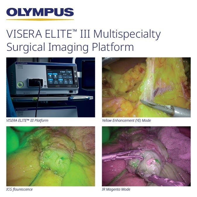 The VISERA ELITE™ III surgical imaging platform