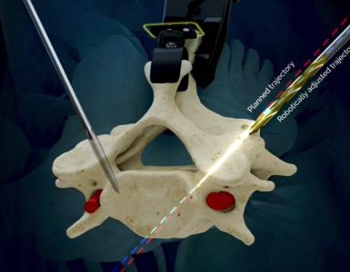 dynamis-robotic-surgical-system