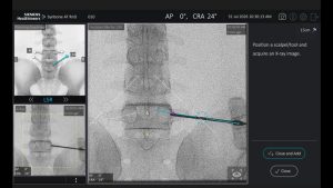 Trackerless Guidance in Spinal Surgery