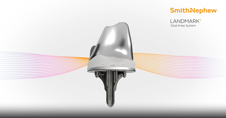 Smith+Nephew Secures FDA 510(k) Clearance for LANDMARK Total Knee System and Completes First Procedures